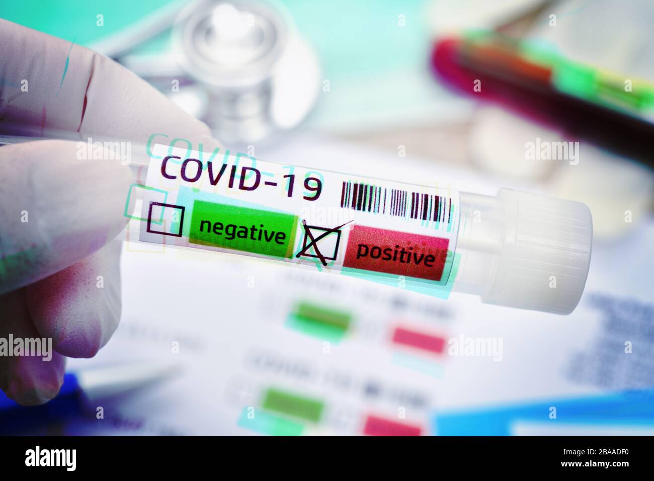 Tubi di deduzione con risultati positivi di Covid 19, foto simbolica di Coronavirus, Abstrich-Röhrchen mit positivem Covid-19-Befund, Symbolfoto Coronavirus Foto Stock