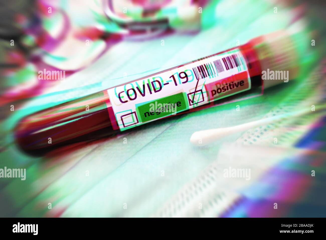 Analisi del sangue con risultati positivi di Covid 19, foto simbolica Coronavirus, Blutprobe mit positivem Covid-19-Befund, Symbolfoto Coronavirus Foto Stock