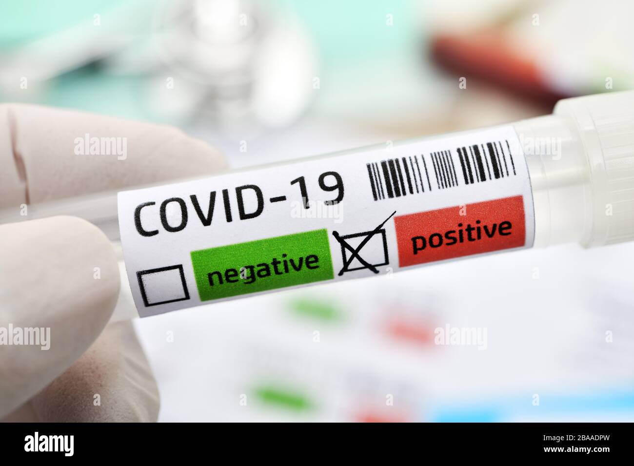 Tubi di deduzione con risultati positivi di Covid 19, foto simbolica di Coronavirus, Abstrich-Röhrchen mit positivem Covid-19-Befund, Symbolfoto Coronavirus Foto Stock