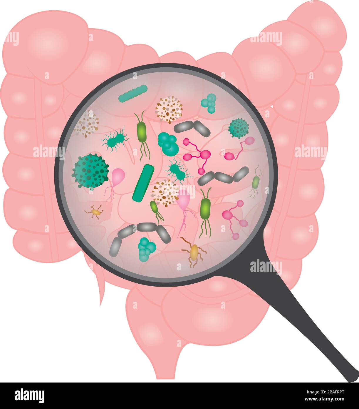 Ipercrescita batterica nell'intestino tenue Immagine e Vettoriale - Alamy