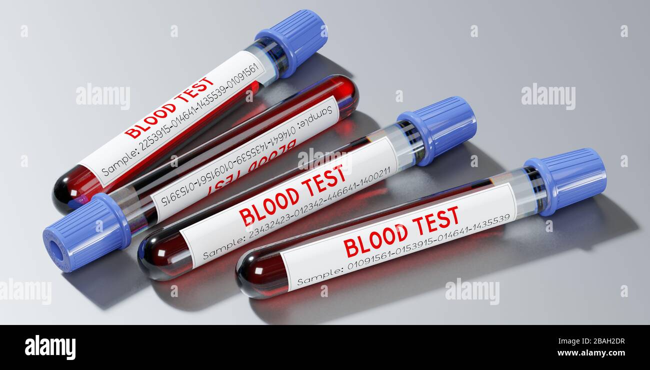 Analisi del sangue, provette - illustrazione 3D Foto Stock