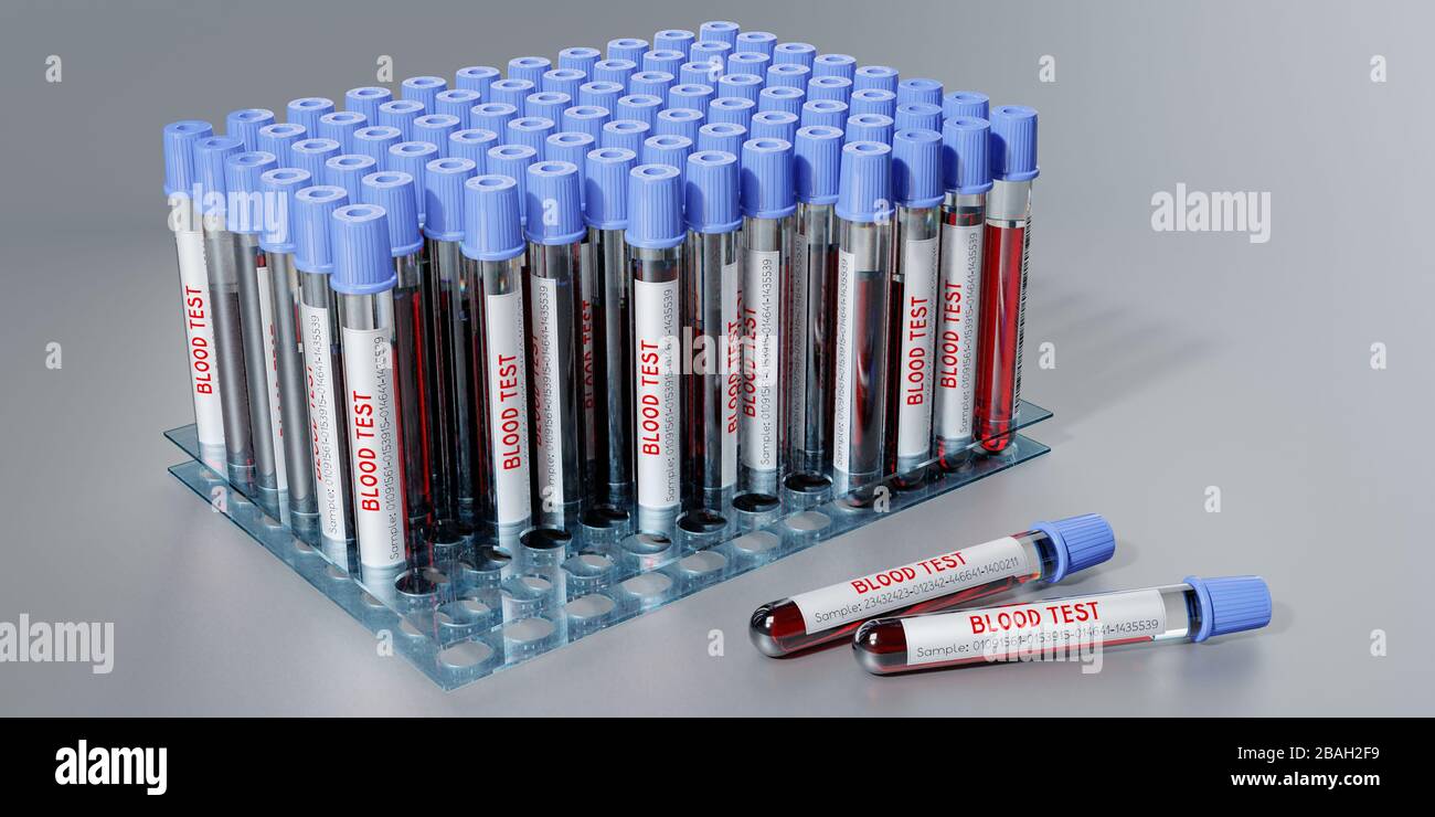 Analisi del sangue, provette - illustrazione 3D Foto Stock
