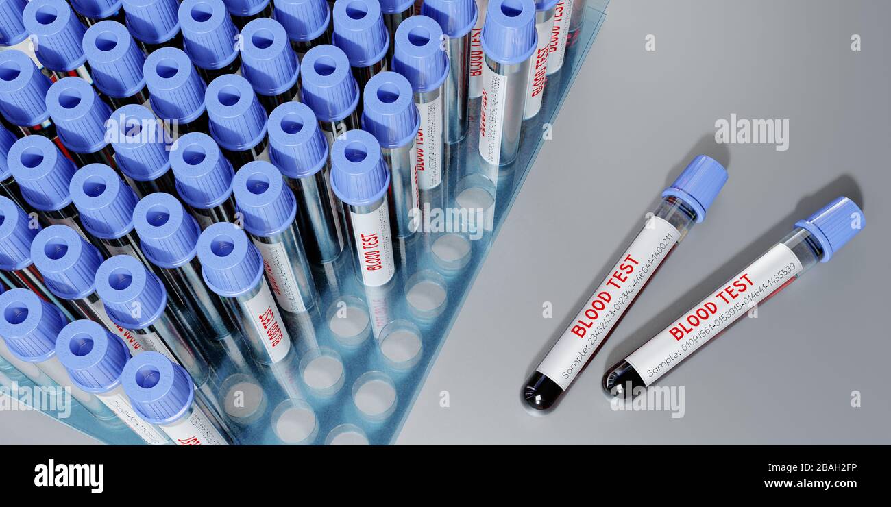 Analisi del sangue, provette - illustrazione 3D Foto Stock
