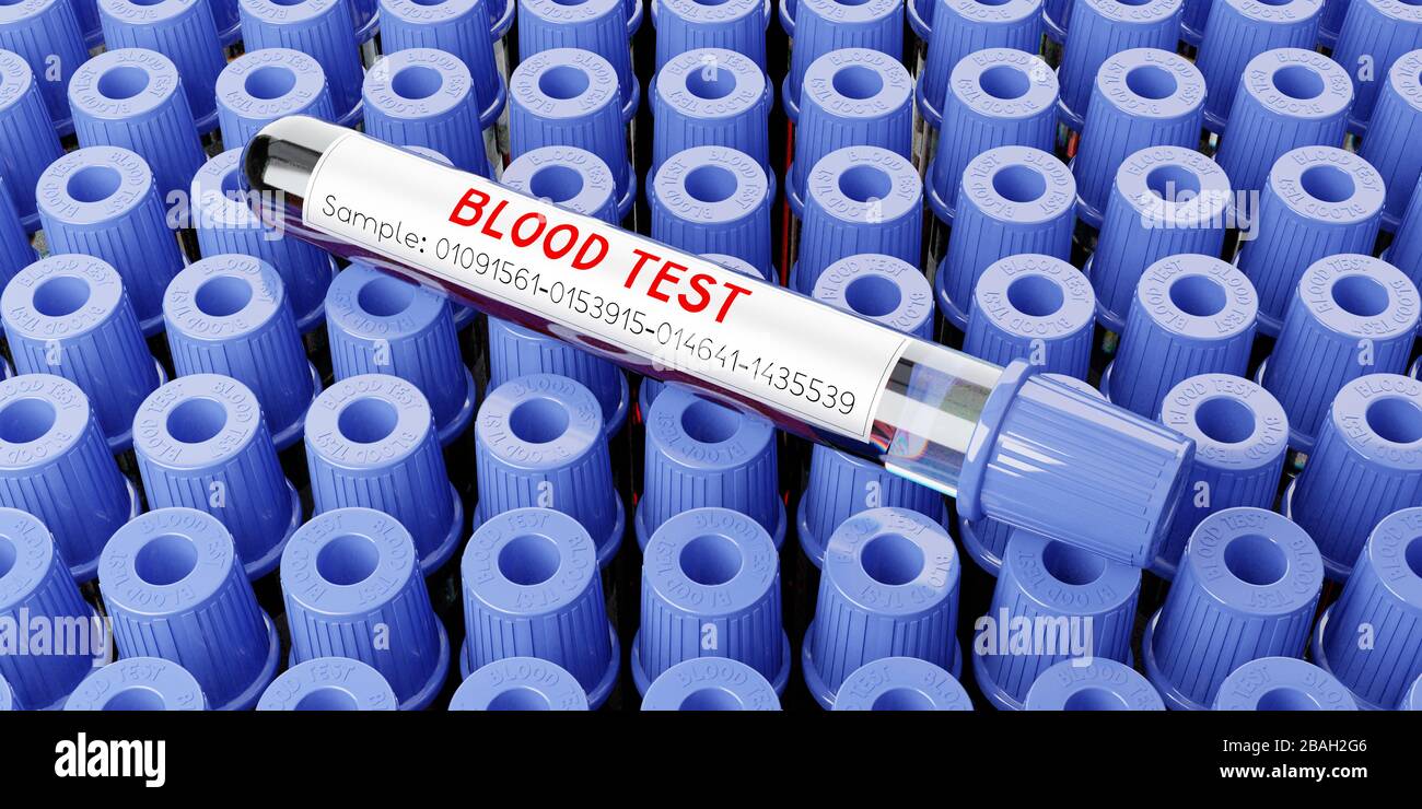 Analisi del sangue, provette - illustrazione 3D Foto Stock