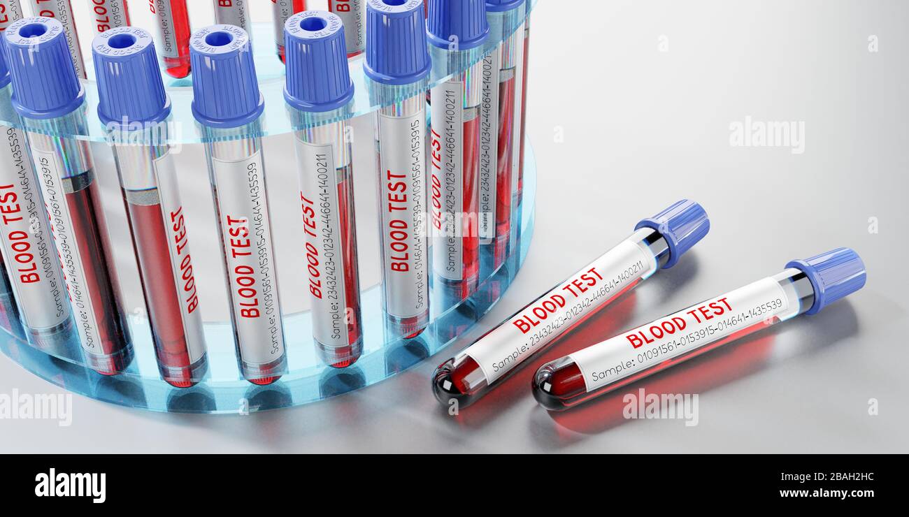 Analisi del sangue, provette - illustrazione 3D Foto Stock
