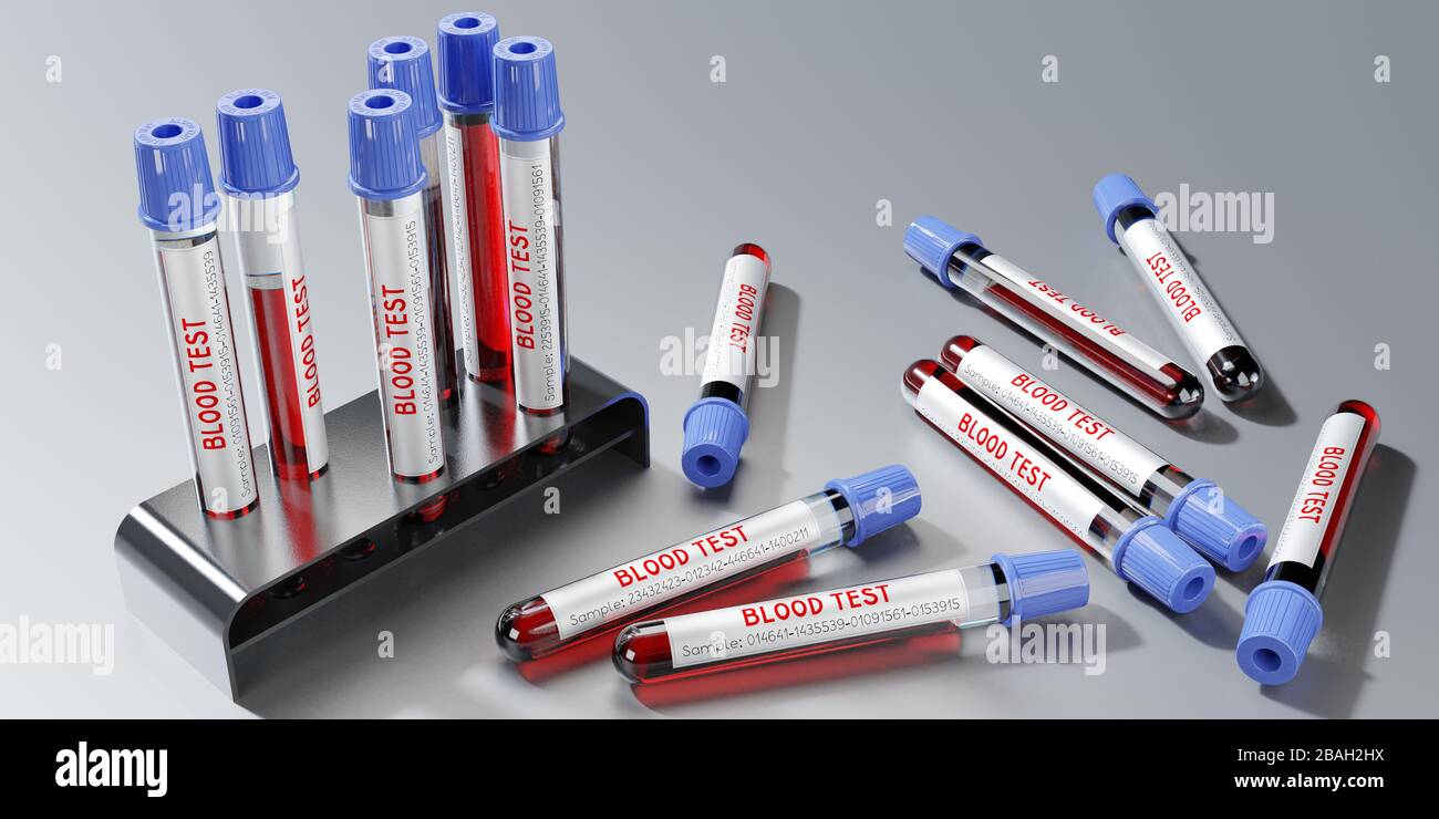 Analisi del sangue, provette - illustrazione 3D Foto Stock