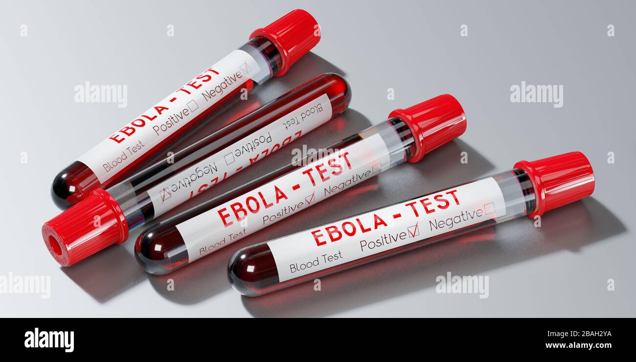 Virus Ebola - provette per analisi, esami del sangue - illustrazione 3D Foto Stock