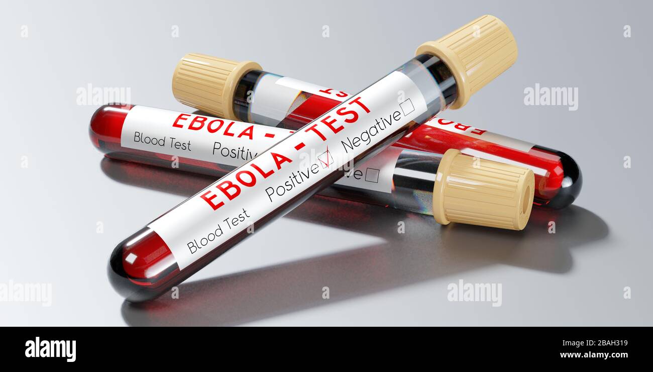 Virus Ebola - provette per analisi, esami del sangue - illustrazione 3D Foto Stock