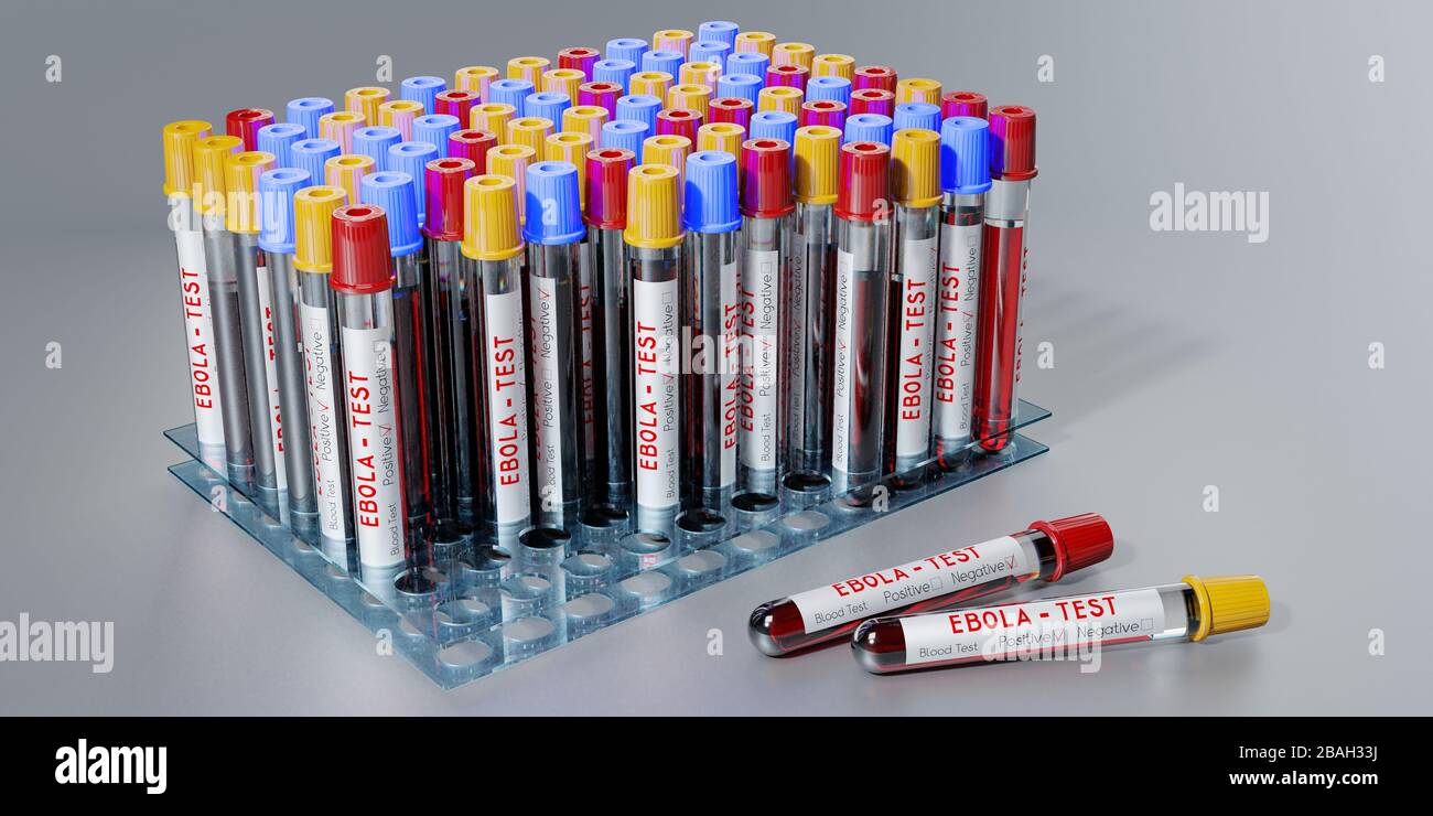 Virus Ebola - provette per analisi, esami del sangue - illustrazione 3D Foto Stock