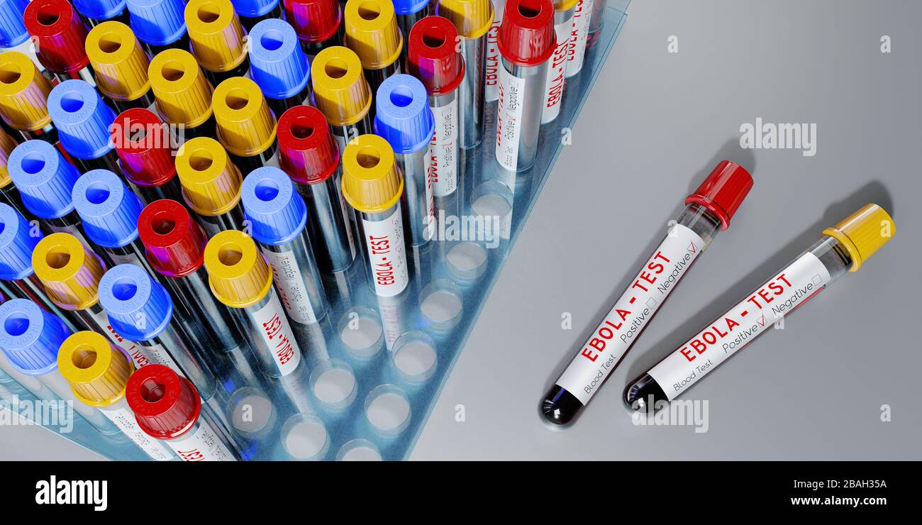 Virus Ebola - provette per analisi, esami del sangue - illustrazione 3D Foto Stock