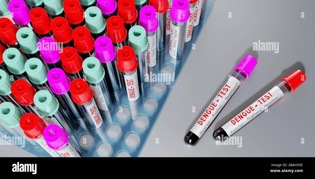 Virus dengue - provette per analisi, esami del sangue - illustrazione 3D Foto Stock