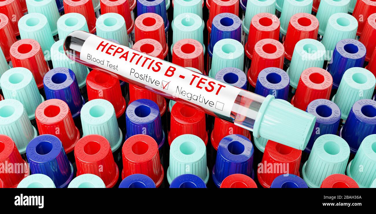 Virus dell'epatite B - provette, esami del sangue - illustrazione 3D Foto Stock