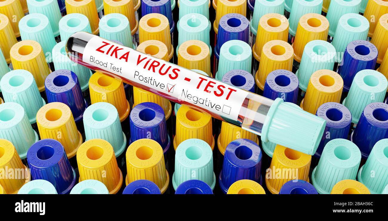 Virus ZIKA - provette per analisi, esami del sangue - illustrazione 3D Foto Stock