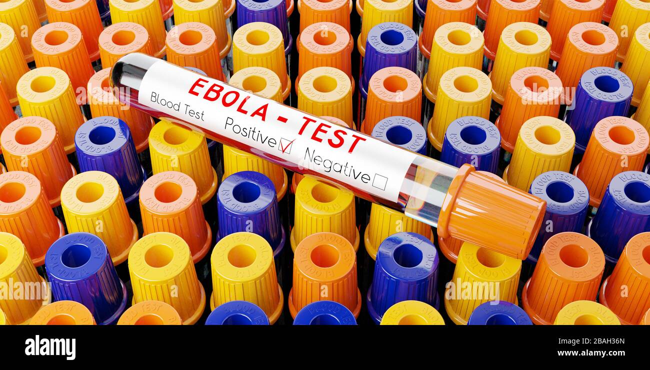 Virus Ebola - provette per analisi, esami del sangue - illustrazione 3D Foto Stock