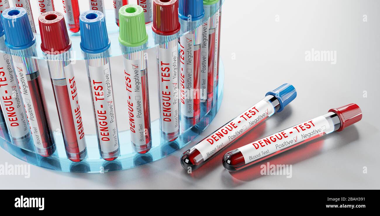 Virus dengue - provette per analisi, esami del sangue - illustrazione 3D Foto Stock