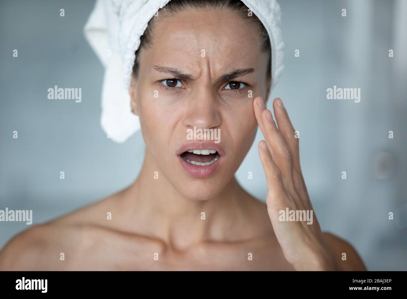 La donna tocca il viso si sente stressato circa le prime rughe mimiche Foto Stock