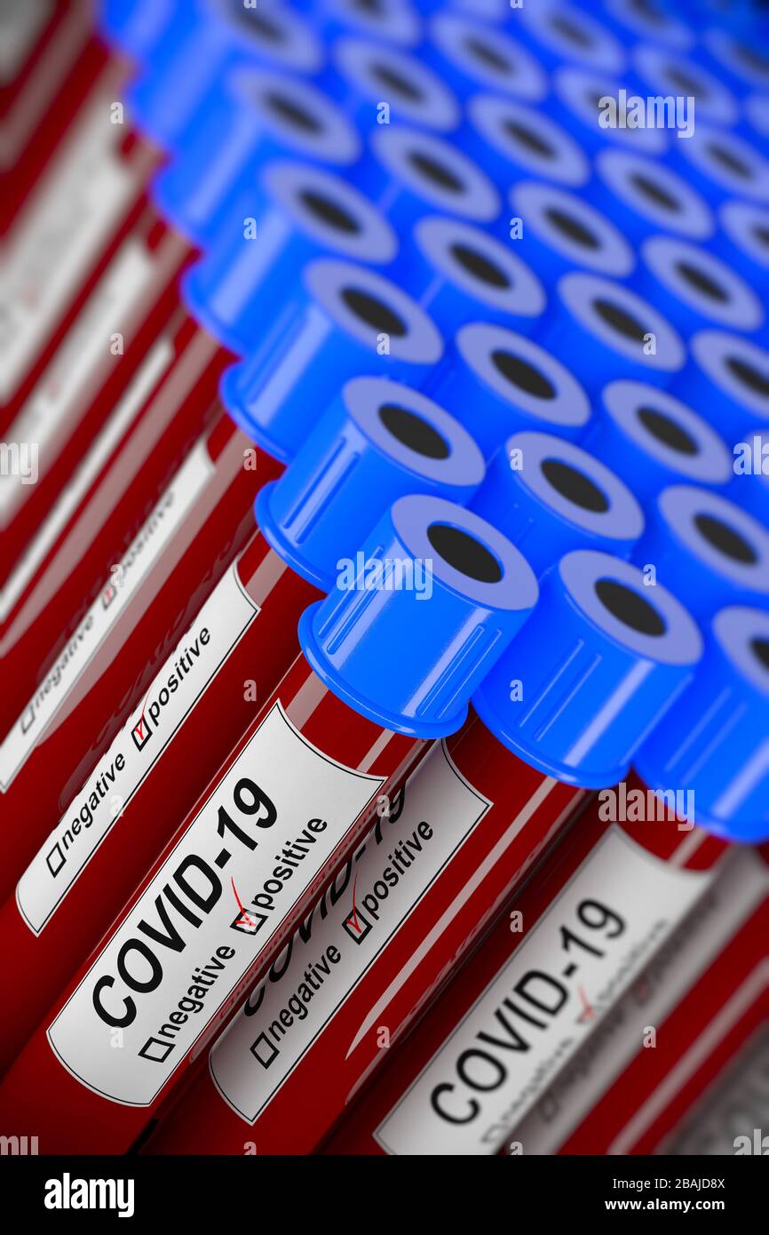 Illustrazione 3D di molte provette per analisi del sangue con test COVID-19 positivi. Concetto per campione di laboratorio di analisi del sangue per la diagnosi del virus Corona. Foto Stock