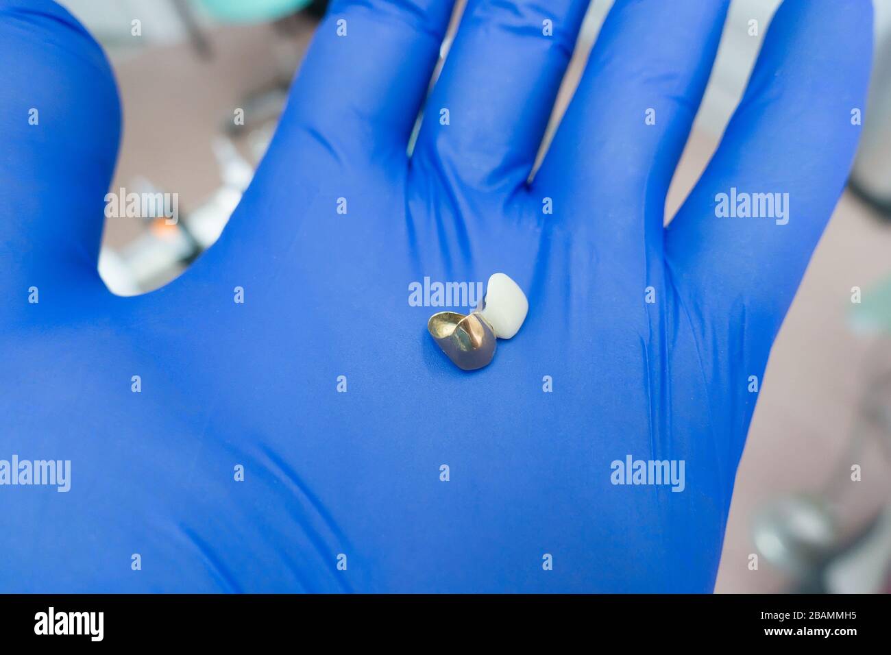 strutture dentali artificiali nelle mani di un dentista Foto Stock