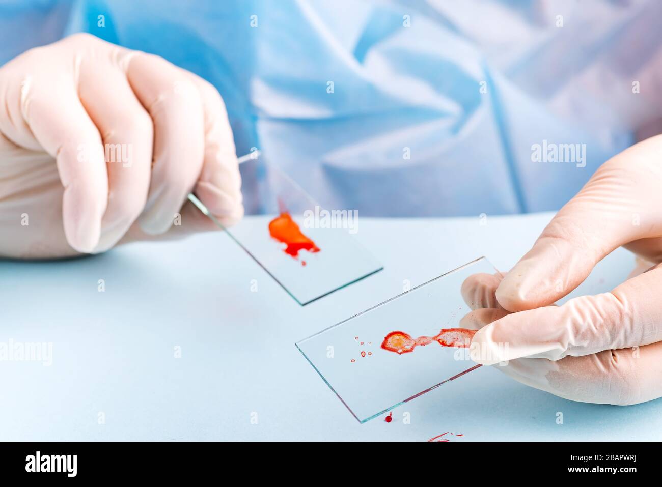 tecnico di laboratorio che gocciola sangue rosso umano sul vetrino per un test antivirus su sfondo blu Foto Stock