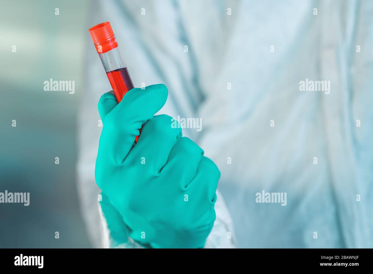 Epidemiologo con campione di sangue nella provetta, fuoco selettivo Foto Stock
