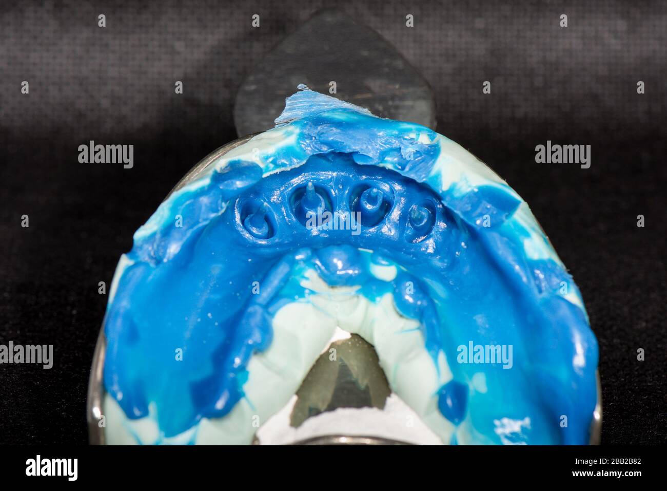 impronta in silicone di denti umani primo piano. produzione di corone dentarie e spine di radice. Foto Stock