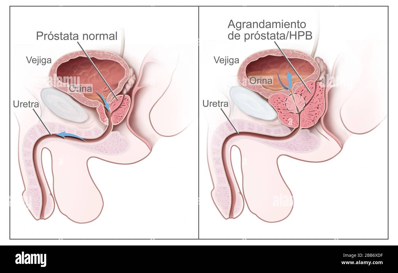 Uretra Immagini E Fotos Stock Alamy