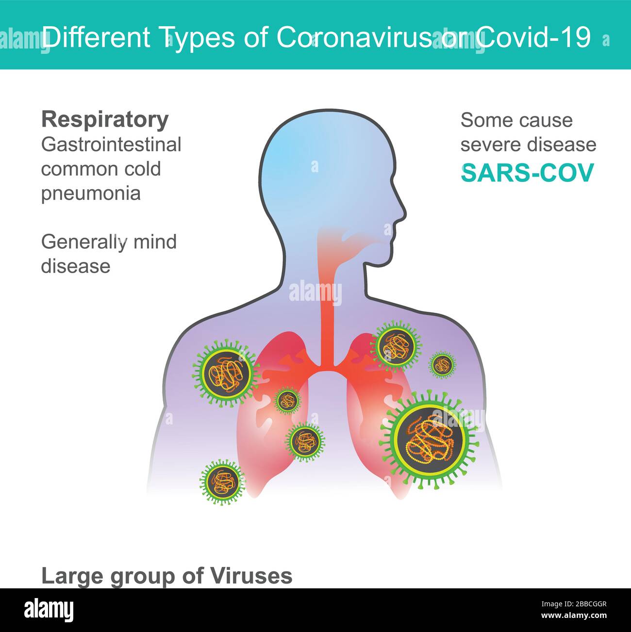 Diversi tipi di Coronavirus o Covid-19. Illustrazione sanità e medico. Illustrazione Vettoriale