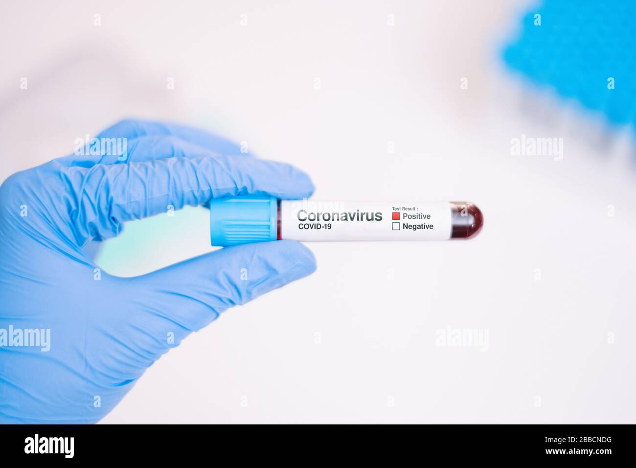 Tuta monouso indossabile da infermiere con maschera e sicurezza google con esito positivo del test del sangue.Pandemic 2019 Coronavirus 2019-nCoV. Foto Stock