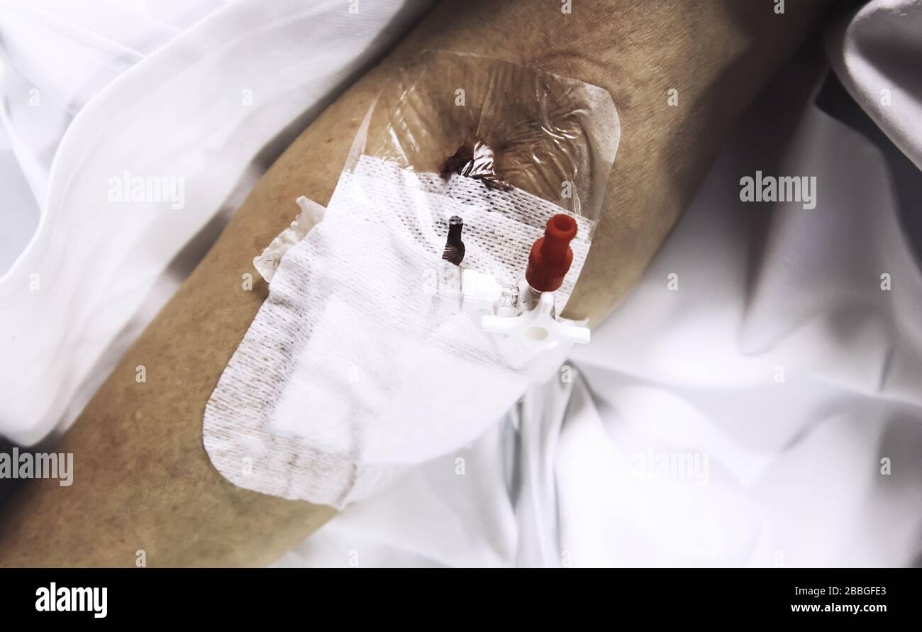 Via endovenosa nel braccio di un paziente ospedaliero, salute e medicina Foto Stock