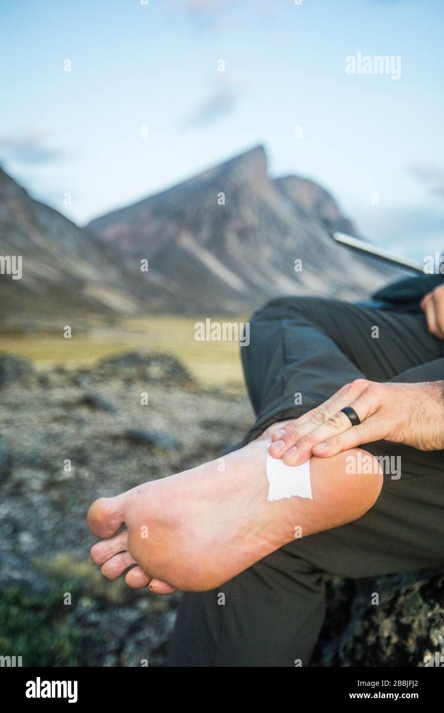 Hiker nastri piede dove il blister stava formando sul piede. Foto Stock