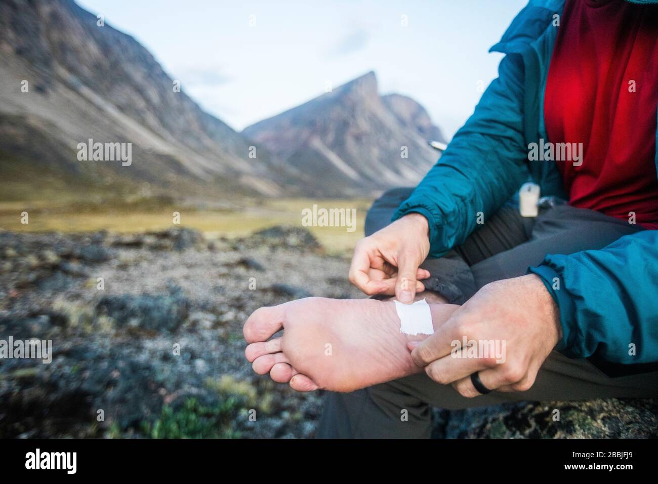 Hiker nastri piede dove il blister stava formando sul piede. Foto Stock