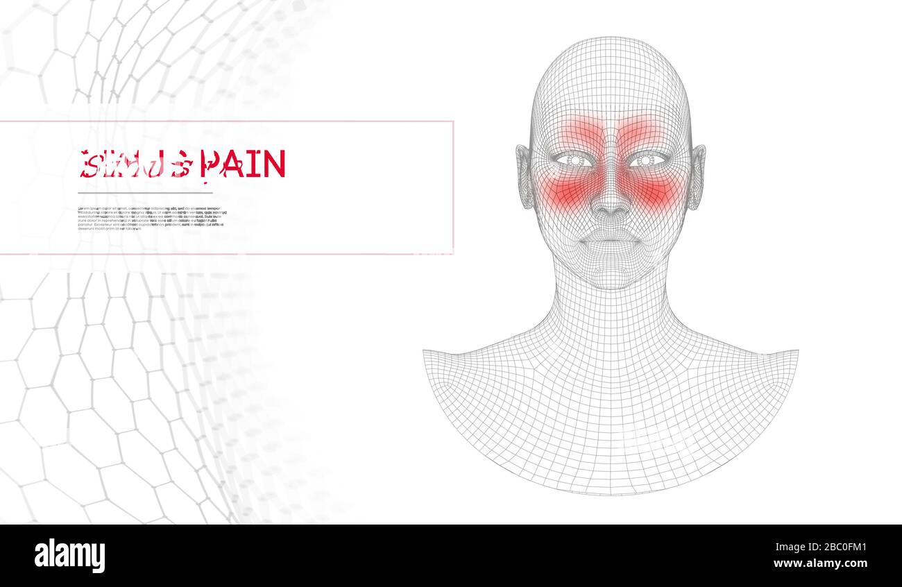 Dolore al seno del naso donna. Infezione nasale, anatomia del naso con dolore al seno frontale. Donna volto umano. Illustrazione vettoriale concetto medico. Illustrazione Vettoriale