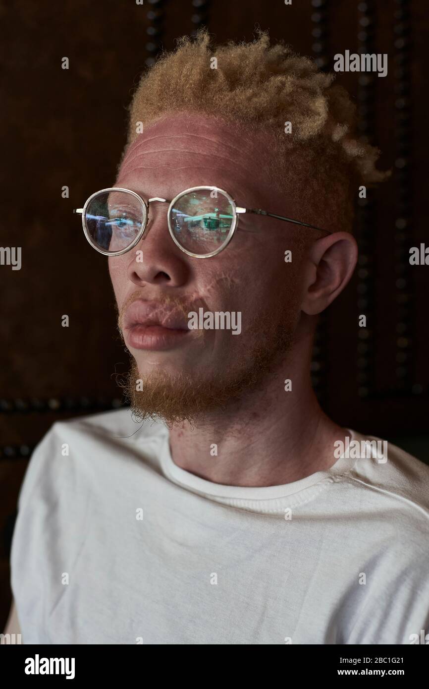 Albino uomo con occhiali rotondi che guardano lateralmente Foto Stock