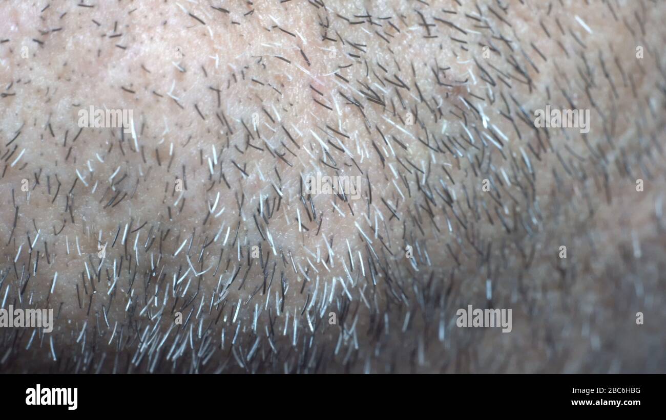 Capelli corti sul viso immagini e fotografie stock ad alta risoluzione