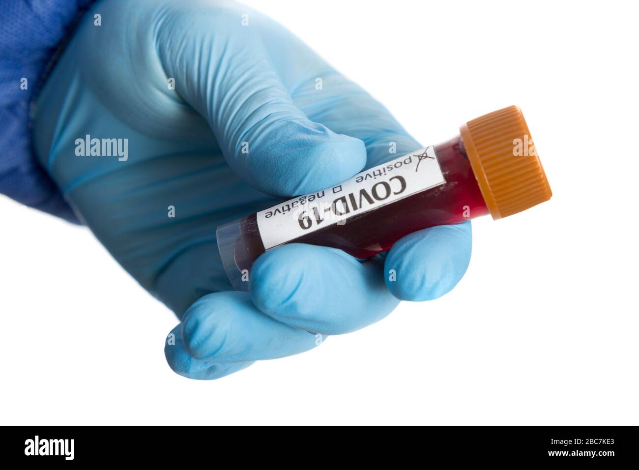 Provetta per analisi del sangue in una mano medica con guanti medici blu. Foto Stock