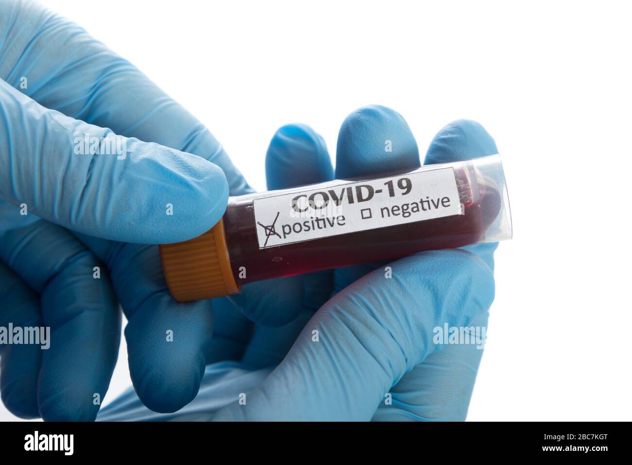 Provetta per analisi del sangue in una mano medica con guanti medici blu. Foto Stock