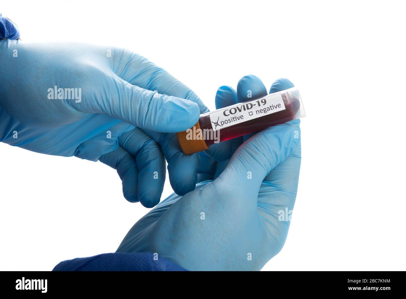 Provetta per analisi del sangue in una mano medica con guanti medici blu. Foto Stock