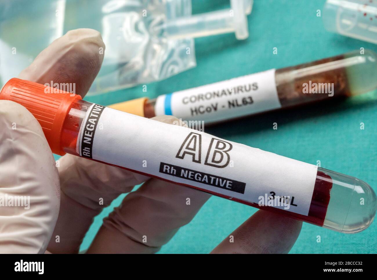 L'infermiere tiene una fiala negativa RH al plasma per trasfondere il paziente con 19, immagine concettuale Foto Stock