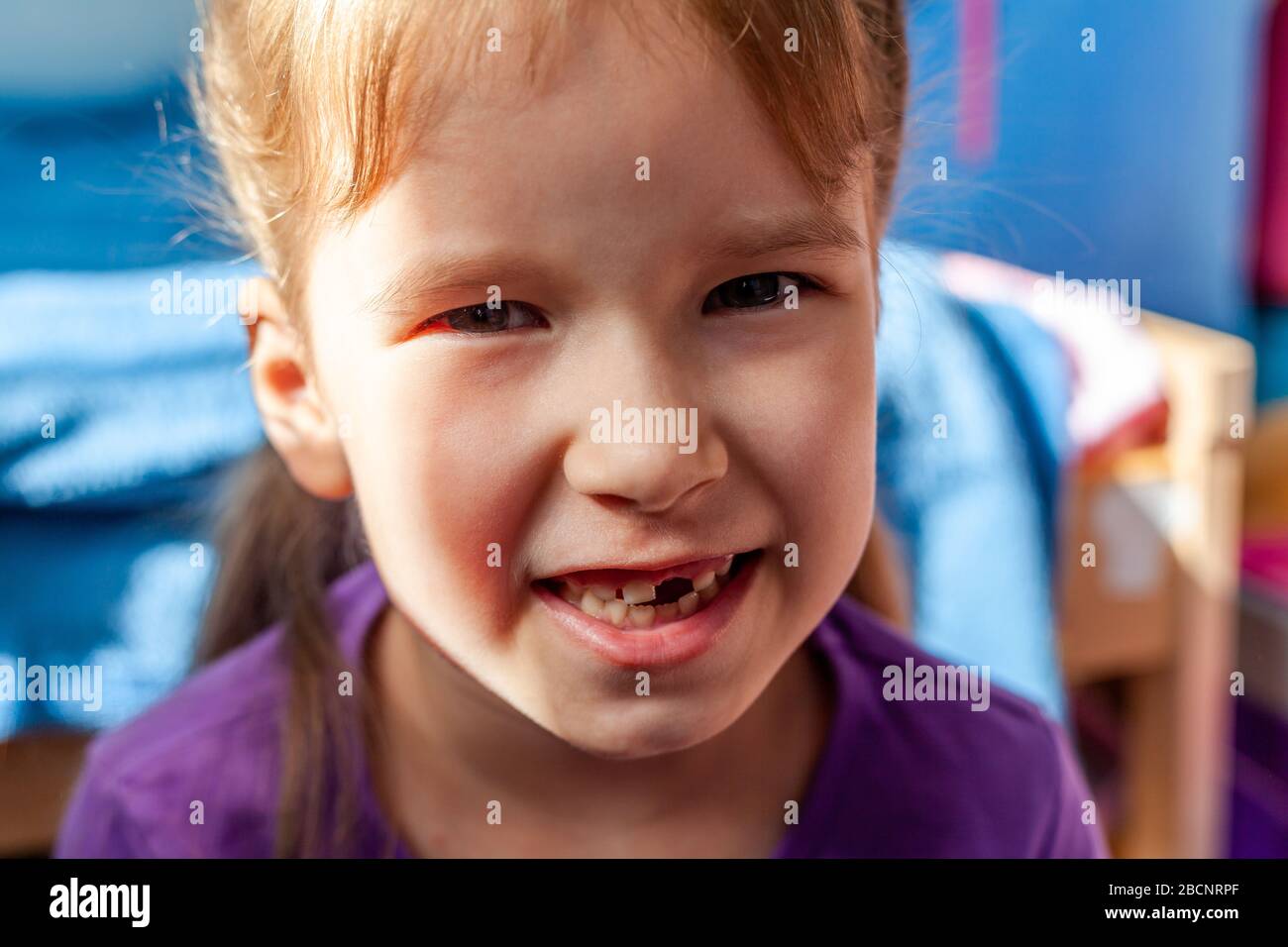 Sorridente bambina manca un dente con la sua bocca aperta mostrando i denti ritratto, closeup bambino felice senza il dente anteriore, latte denti concetto Foto Stock