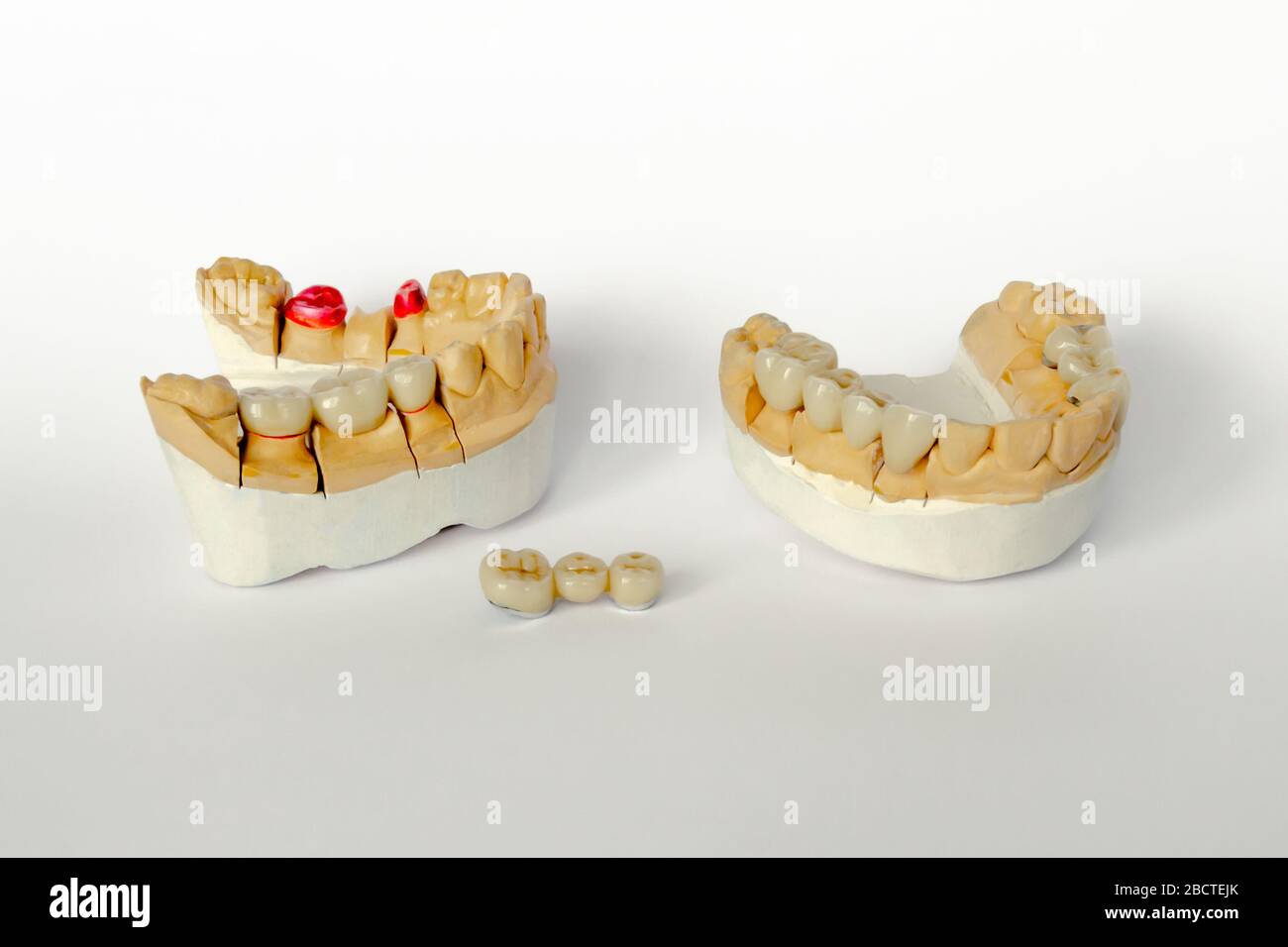 Denti finti mascelle denti modello protesi su sfondo blu primo piano  concetto di assistenza sanitaria dentale