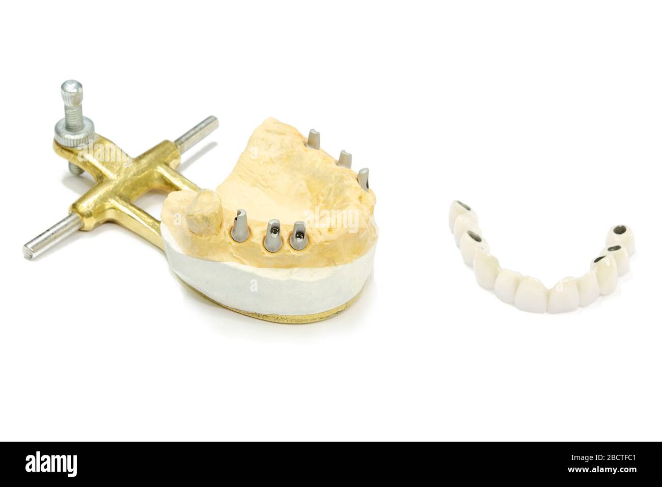 il processo di fabbricazione di denti ceramici su impianti. impianti dentali con denti ceramici su fondo chiaro. concetto di impianto dentale e d Foto Stock