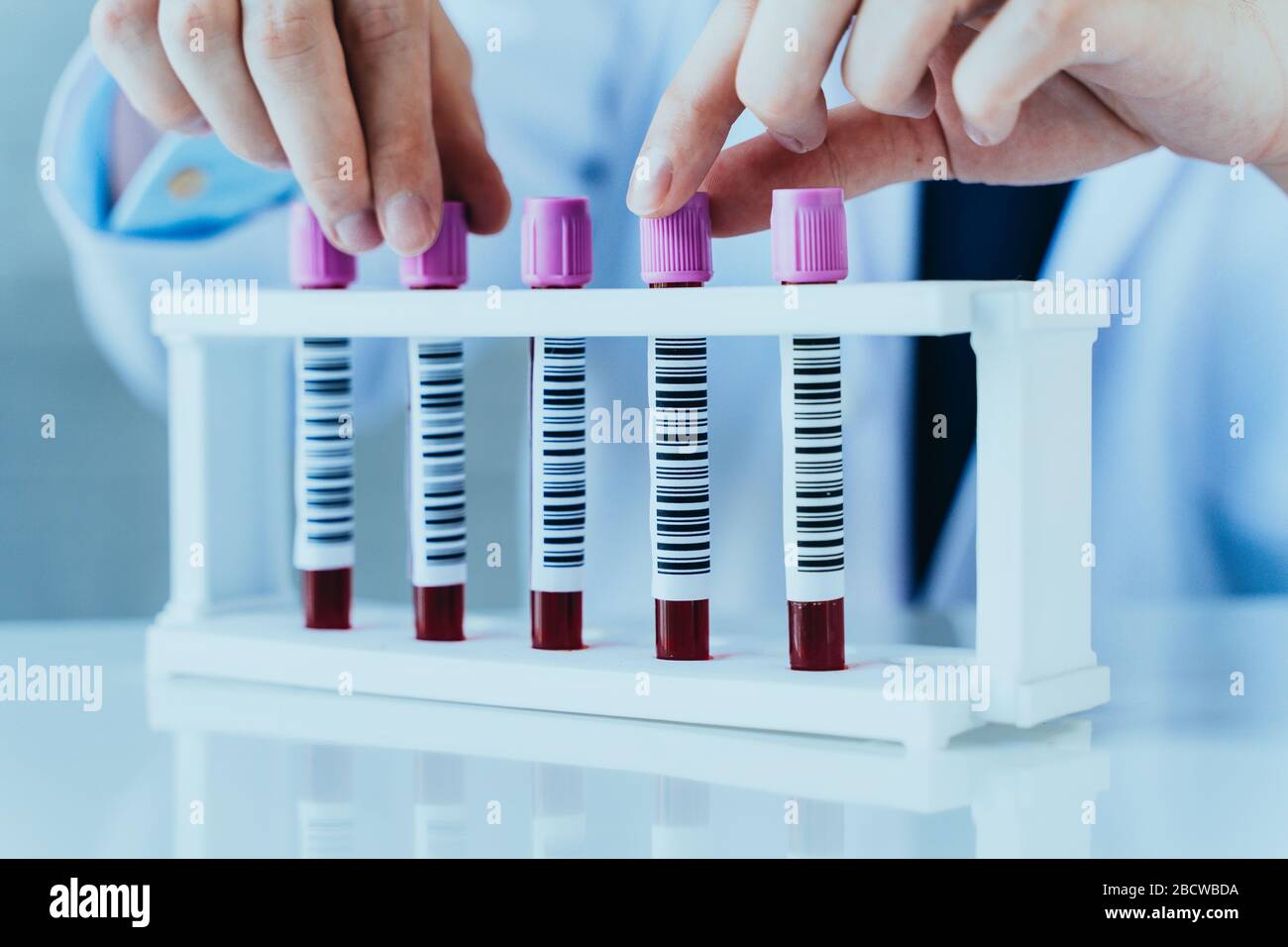 Mani di un tecnico di laboratorio con provette per analisi del sangue in fila per analisi del sangue di laboratorio. Foto Stock