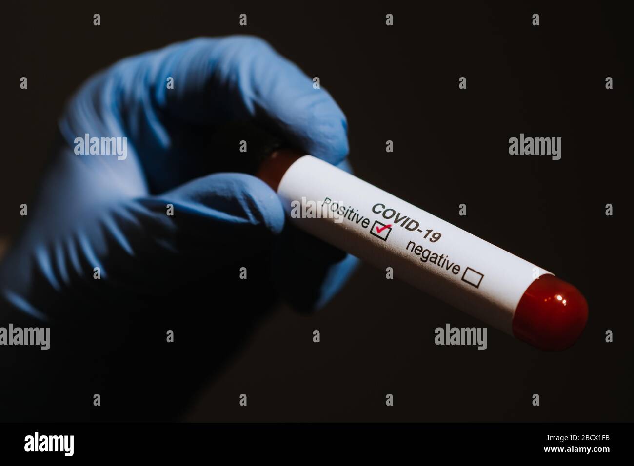 Mano del medico con guanti che tengono la provetta con sangue per coronavirus covid-19 positivo Foto Stock