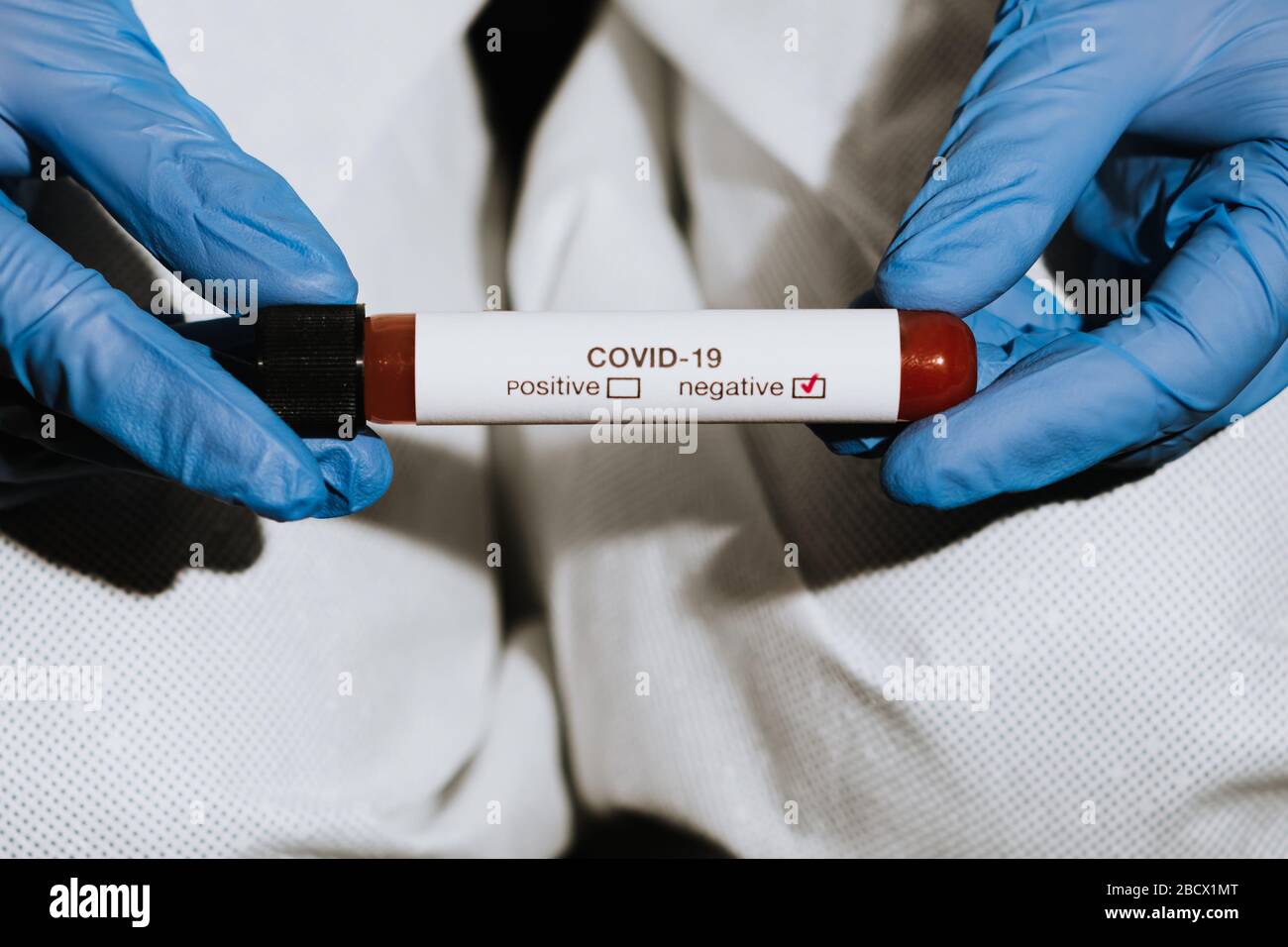 Mano del medico con guanti che tengono la provetta con sangue per coronavirus covid-19 negativo Foto Stock
