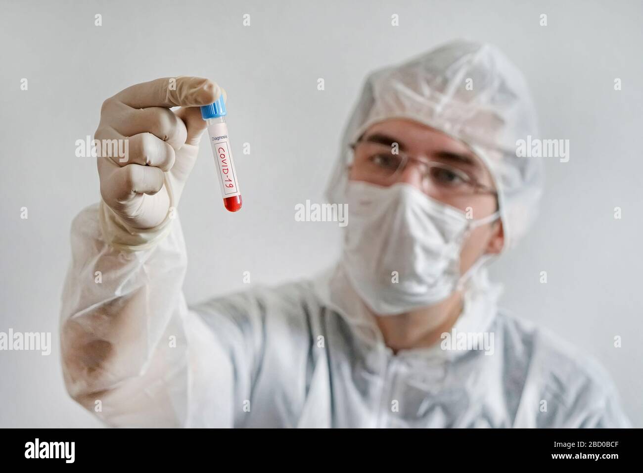 un giovane scienziato indaga un esame del sangue per il coronavirus. Diagnostica 2019-ncov. Risultato positivo del test ematico per covid 19. Medico caucasico con Blo Foto Stock
