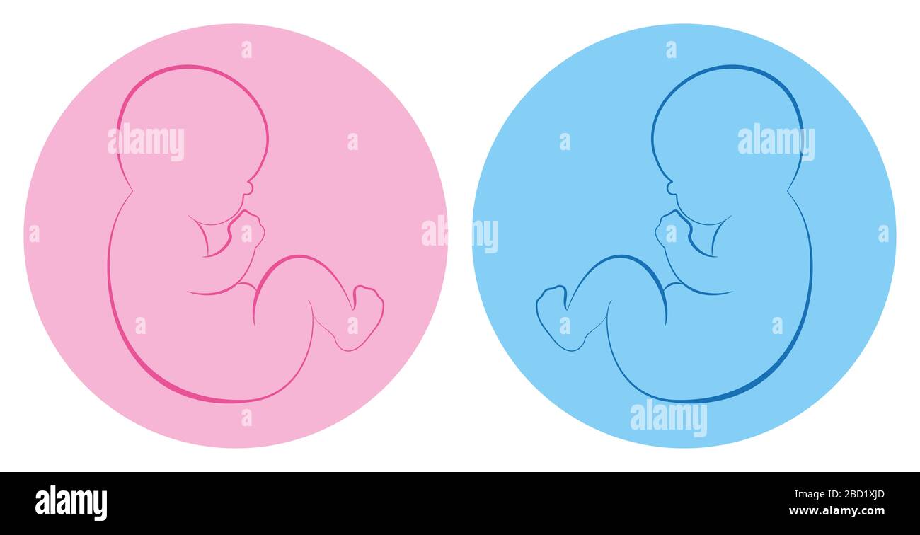 Pittogramma gemelli. Bambino ragazzo e bambina su sfondo blu e rosa rotondo. Foto Stock
