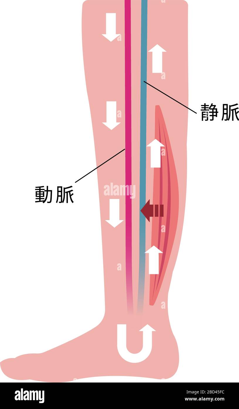 Causa di gonfiore (edema) delle gambe. Illustrazione piatta della gamba normale Illustrazione Vettoriale