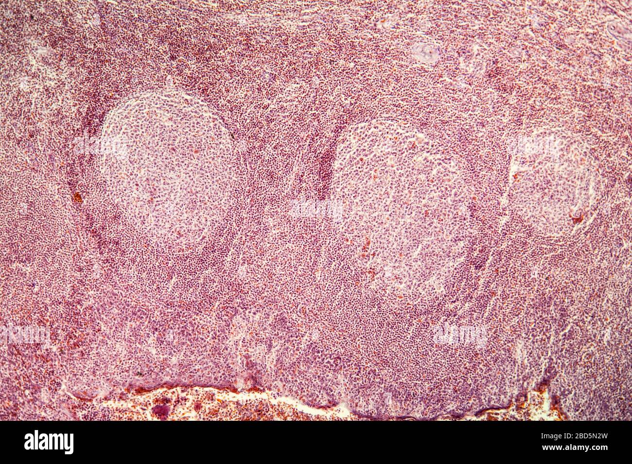Tonsille di mandorla in sezione trasversale al microscopio 100x Foto Stock