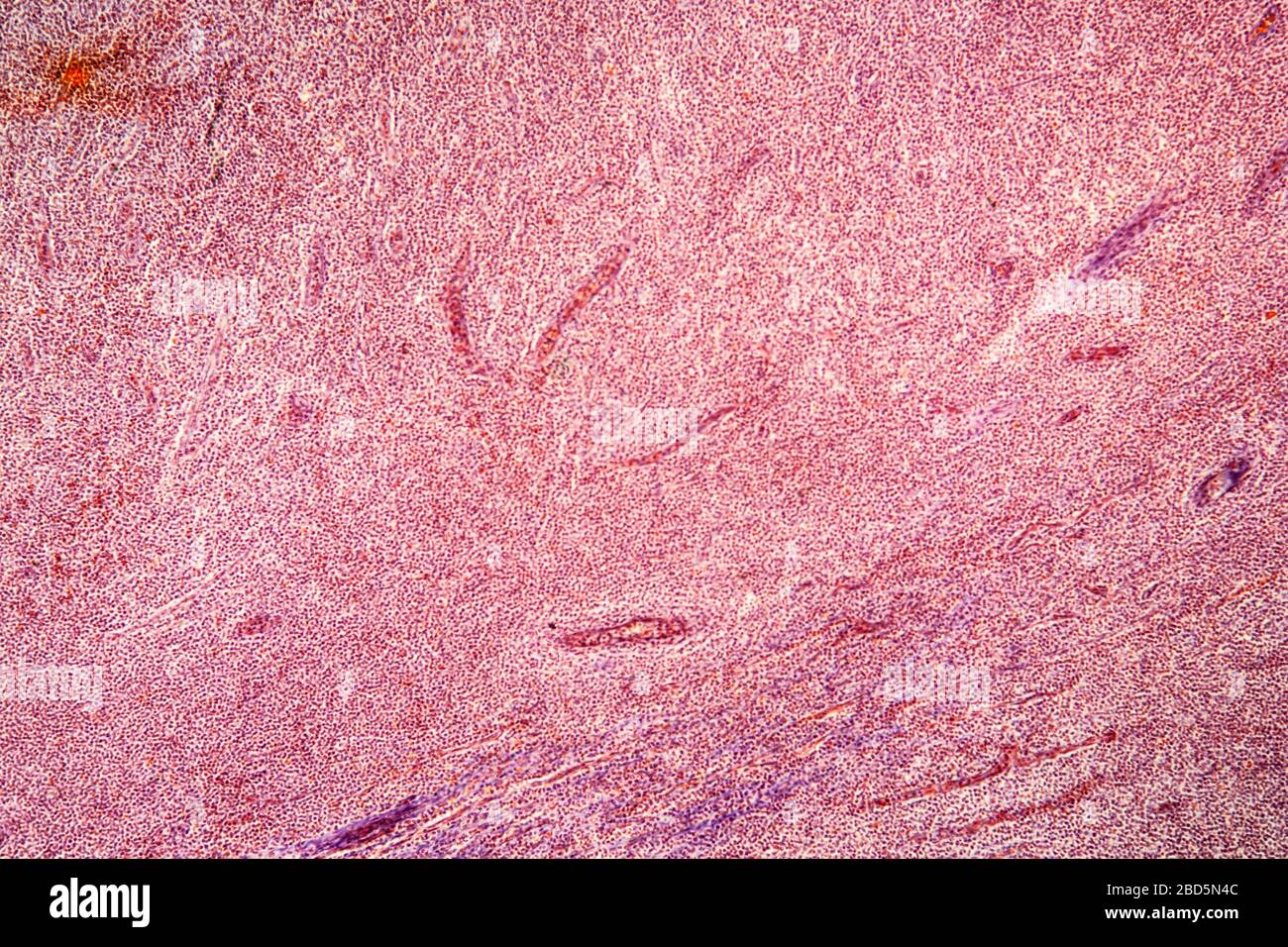 Tonsille di mandorla in sezione trasversale al microscopio 100x Foto Stock