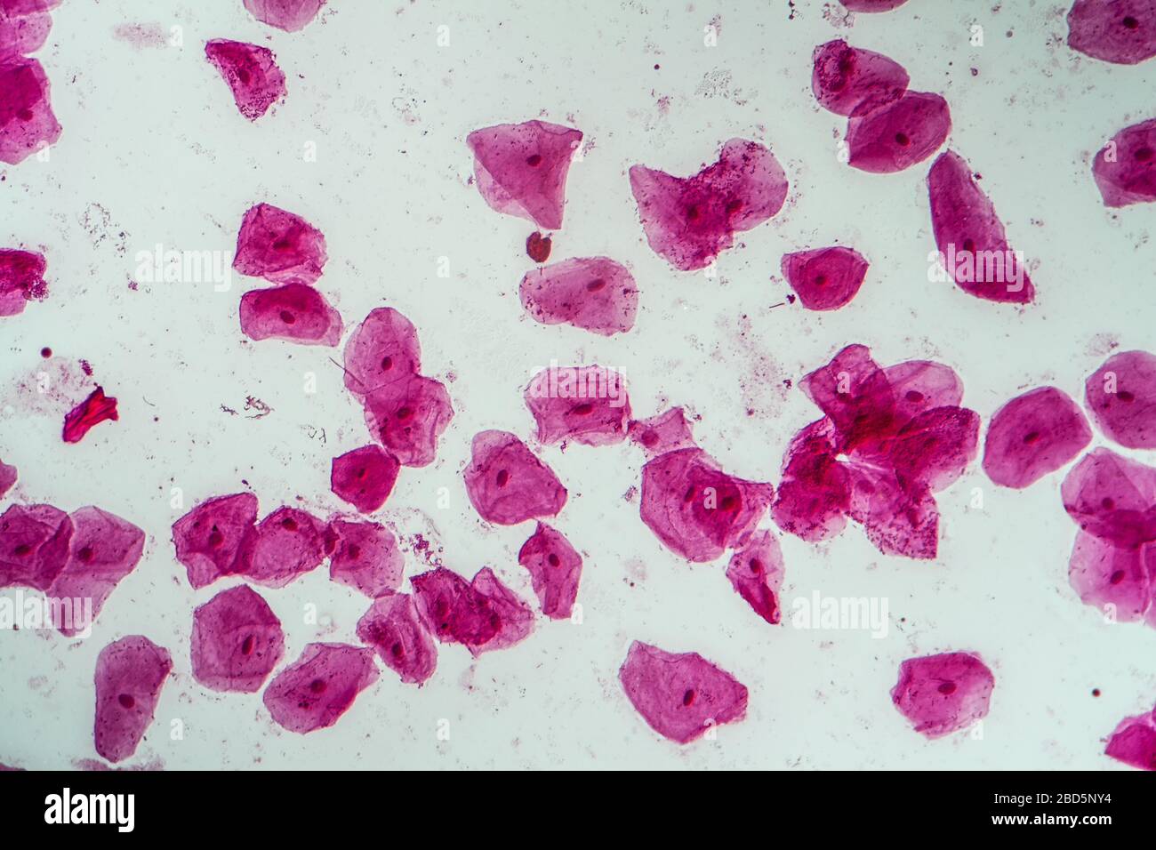 Le cellule epiteliali con batteri dalla cavità orale 200x Foto Stock